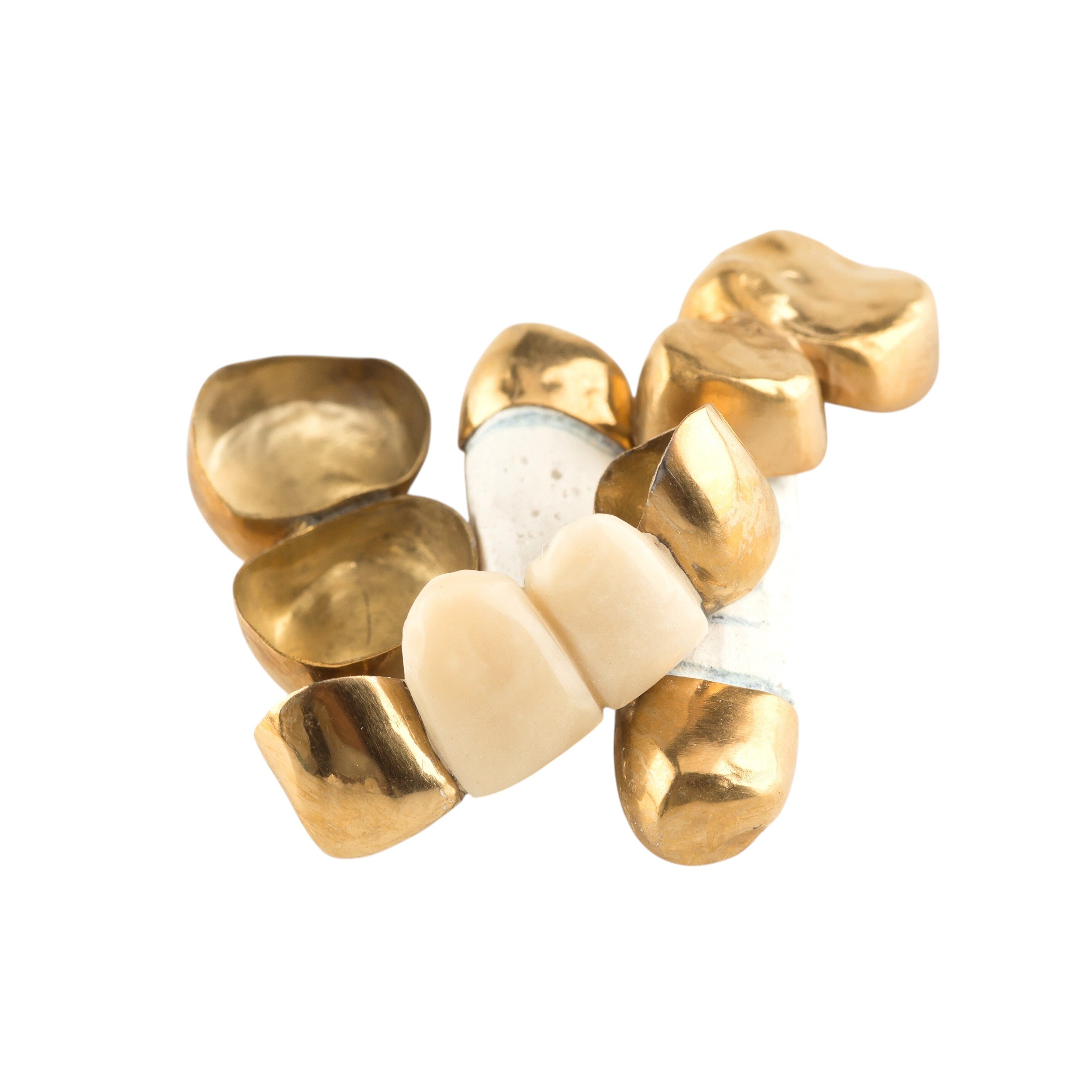 Schwerpunkt - Zahngold